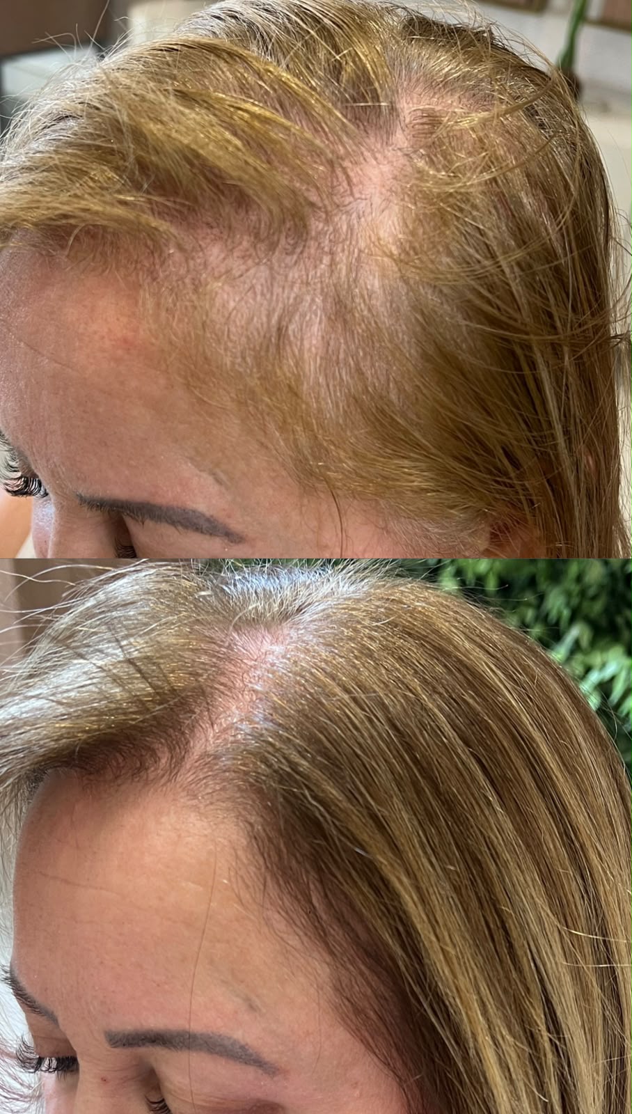 Antes e depois de tratamento capilar 7