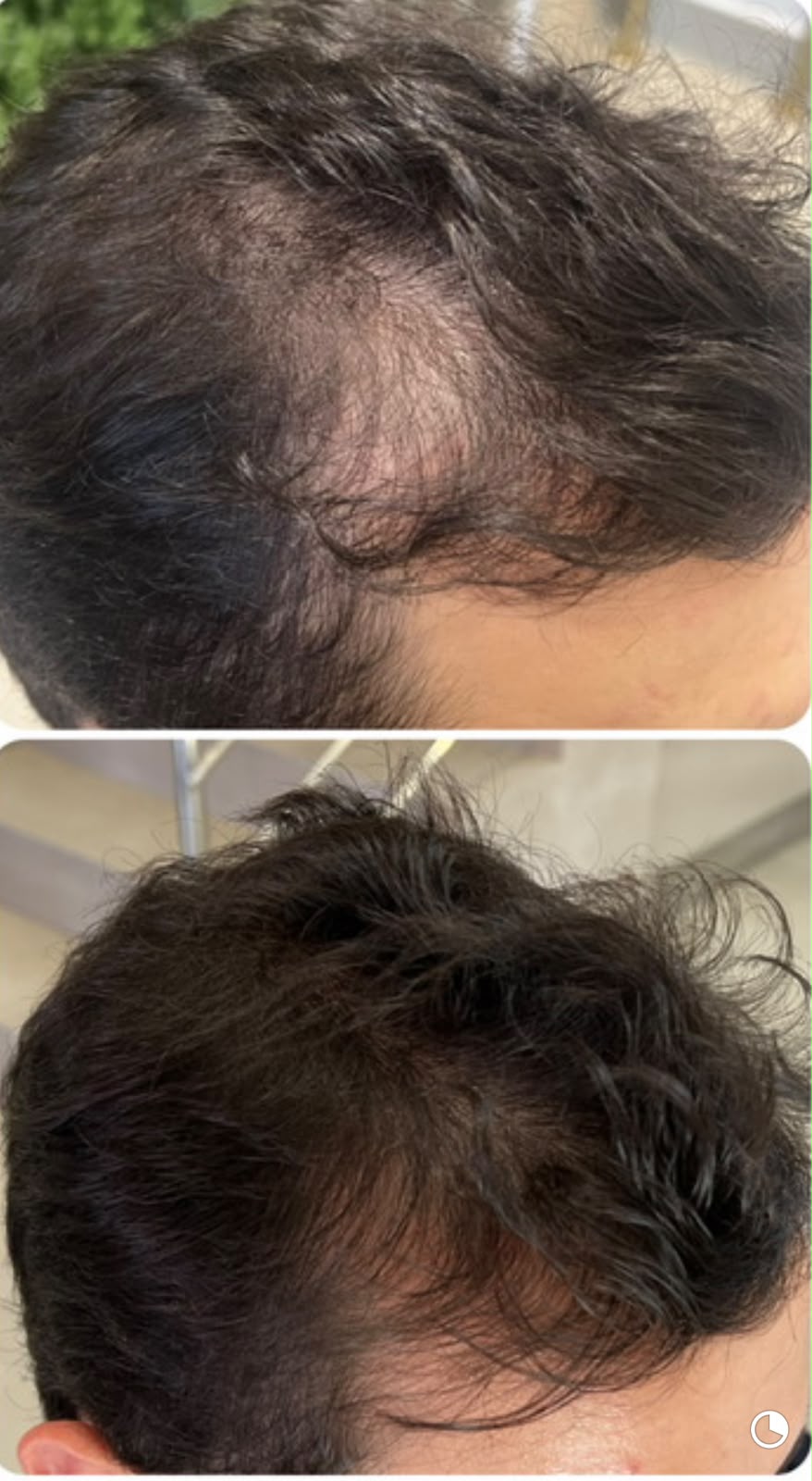 Antes e depois de tratamento capilar 8