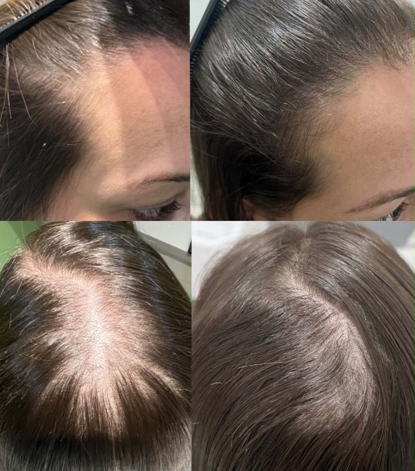 Antes e depois de tratamento capilar 1
