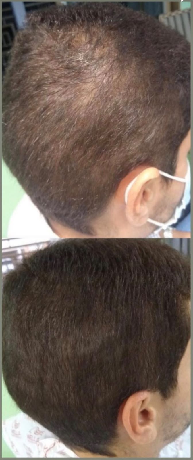 Antes e depois de tratamento capilar 4