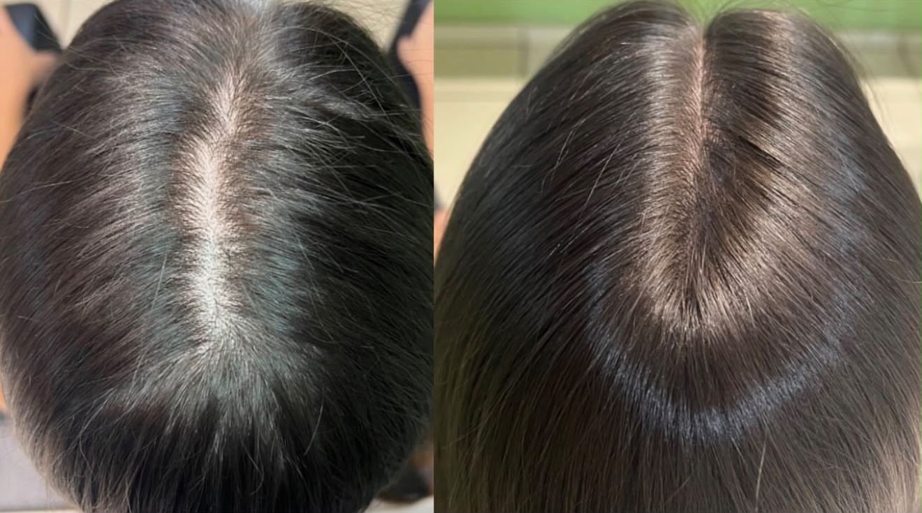 Antes e depois de tratamento capilar 2